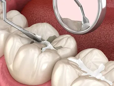 Description for gallery image 3