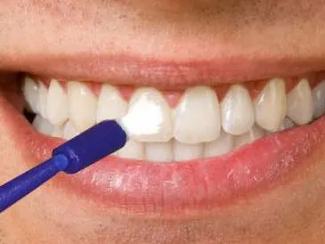 Description for gallery image 6